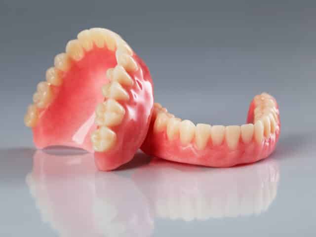All types of fixed dental prostheses