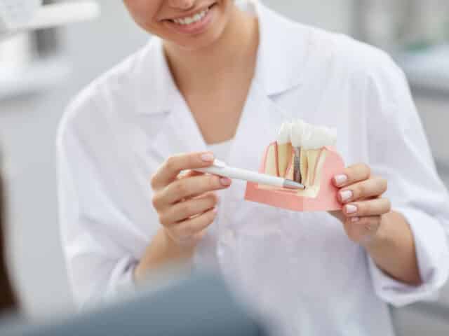 How long does it take to place a dental implant?