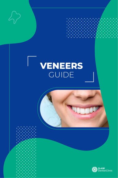 Veneers Guide