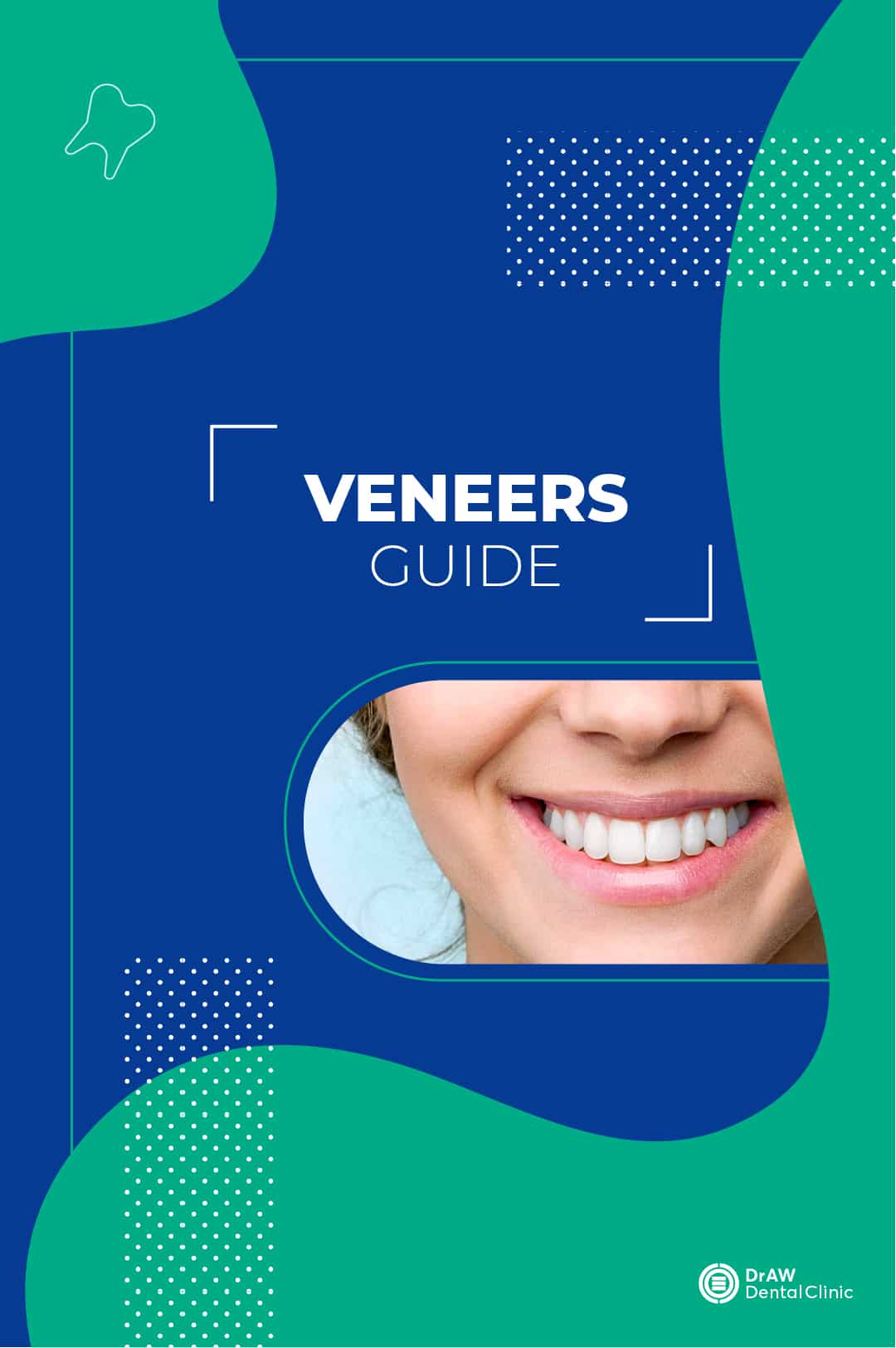 Veneers Guide