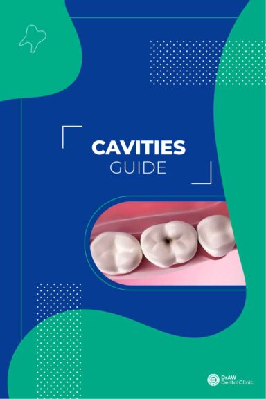 Cavities Guide