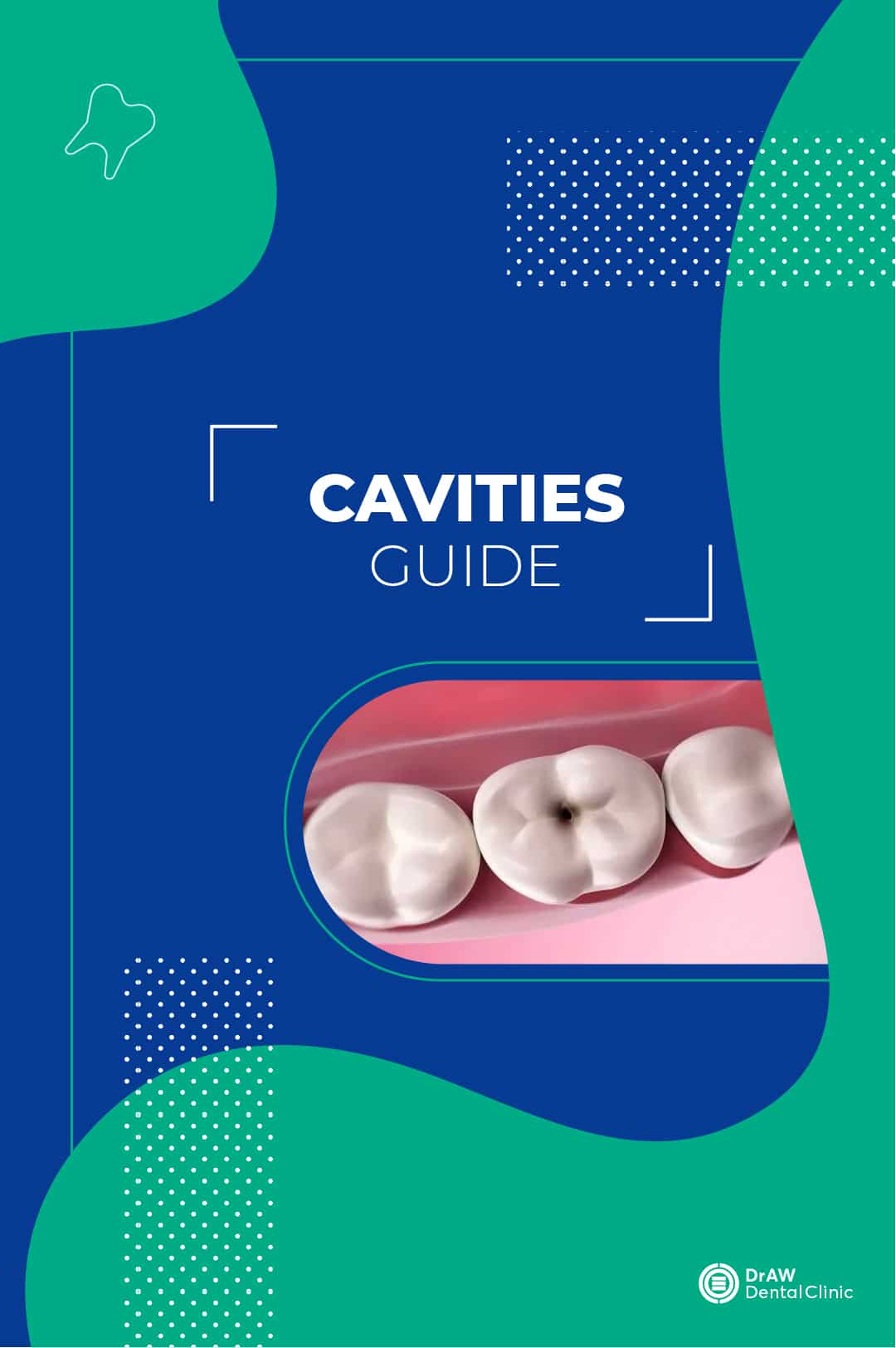 Cavities Guide