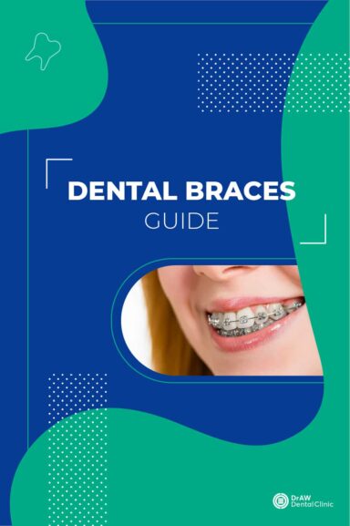 Dental Braces Guide