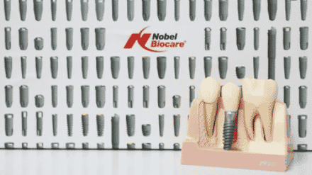 Nobel Biocare - Dental Implant