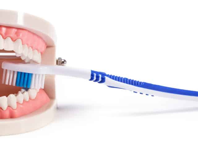 9 recommendations for the aftercare of dental implants