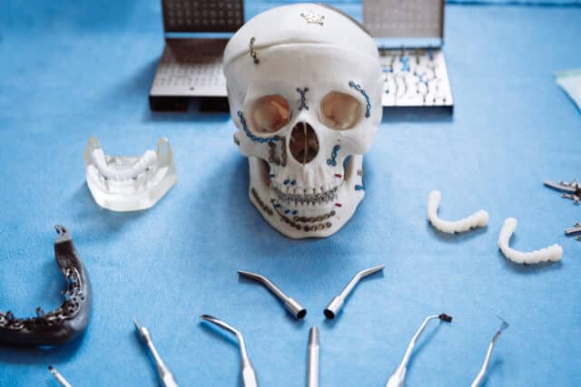 Maxillofacial Surgery - Facial Bones